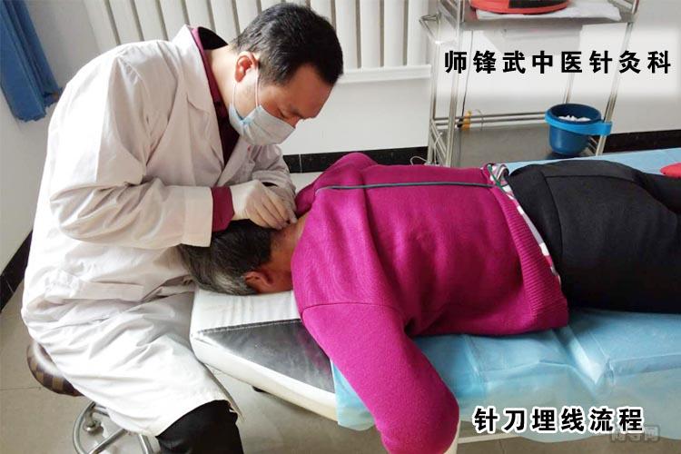 针刀埋线流程