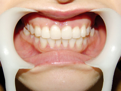 朱氏牙医三十年 免费检查 上门服务!